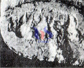 cementado desgaste de la herramienta de carburo